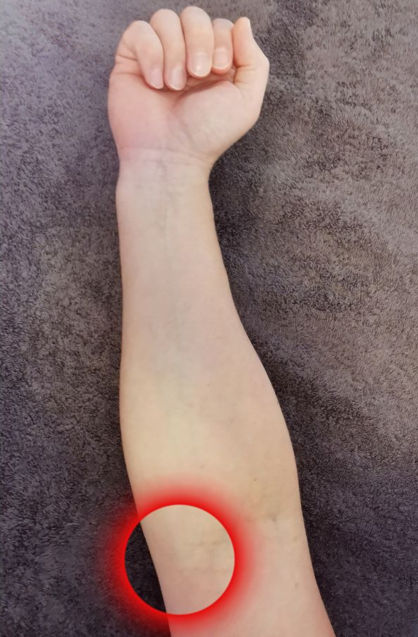 Golfkyynärpää kuvituskuva